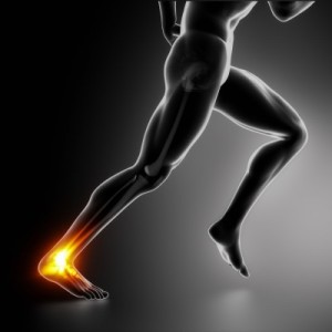 Achilles Tendinitis